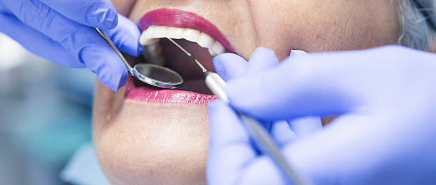 Best Emergency Dental Care for Sports Injuries in Brookside, NJ